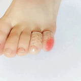 Silicone Anti-Winter Toe Protector