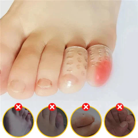 Silicone Anti-Winter Toe Protector